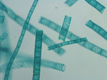MISSING THUMBNAIL